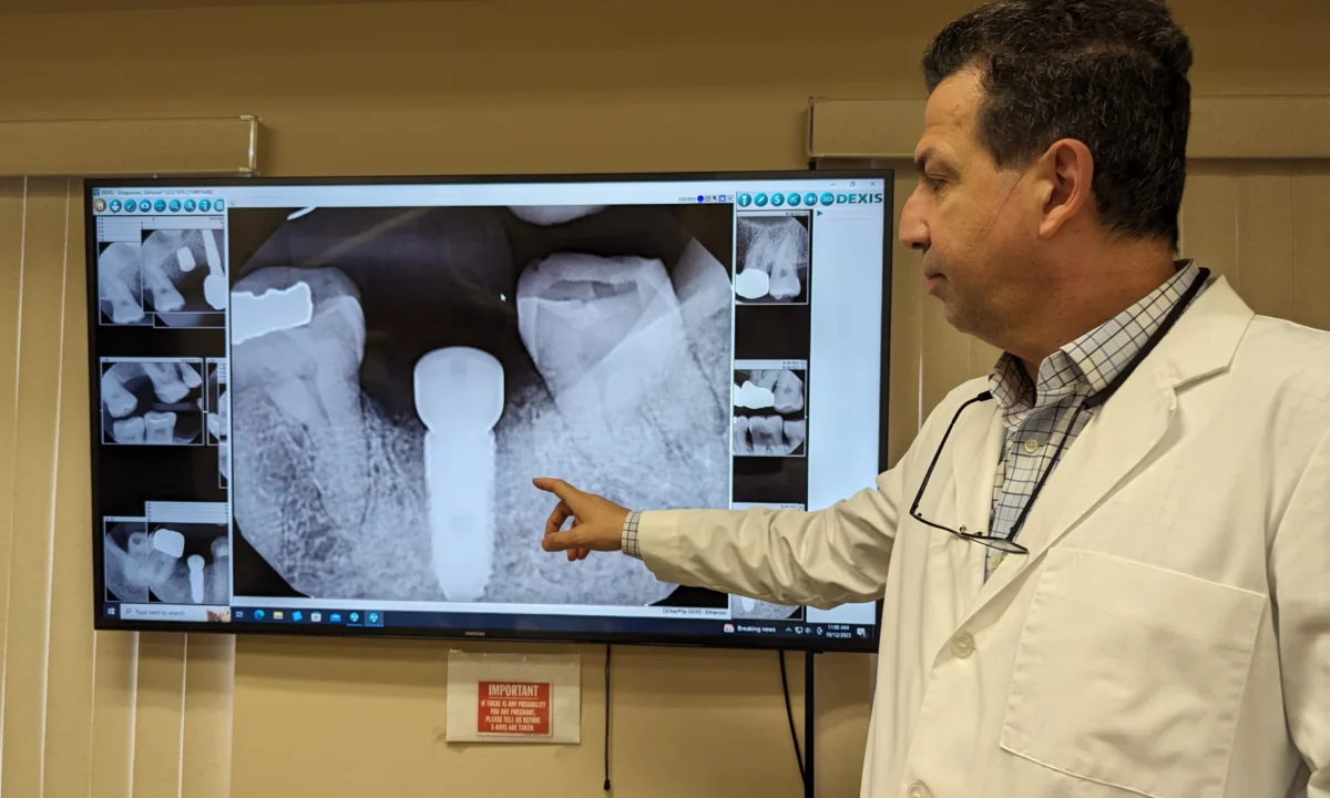 Dental Implants In Fontana CA With Dr. Vahan