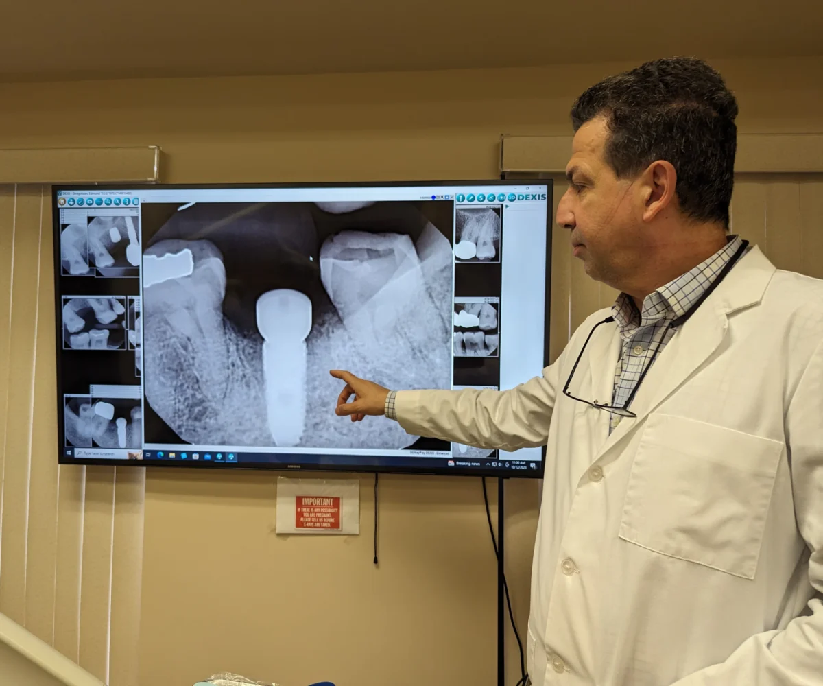 Dental Implants In Fontana CA With Dr. Vahan