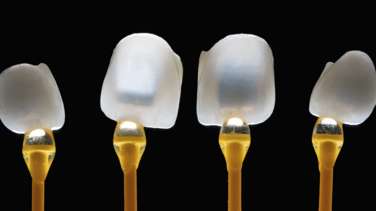 Porcelain Veneers