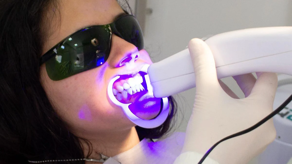 Professional Teeth Whitening Service