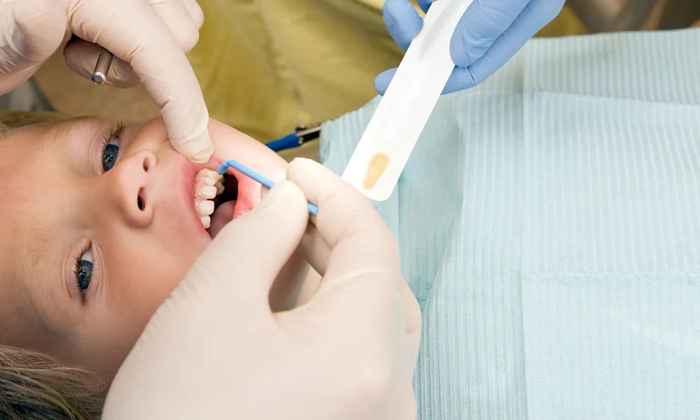Child Receiving Fluoride Treatment