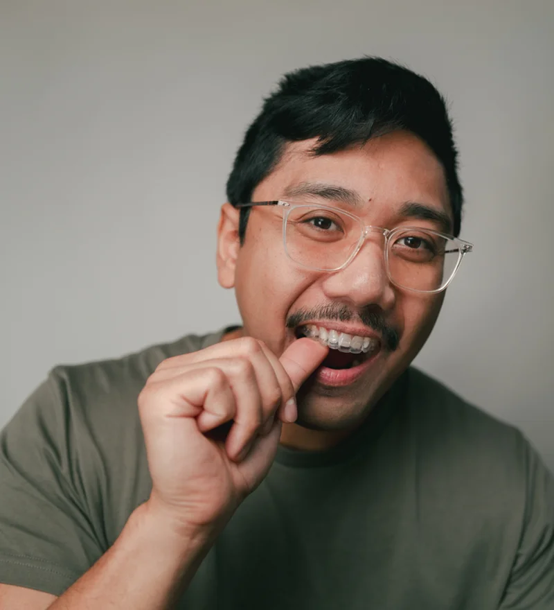 Man Popping Invisalign Tray Into Mouth