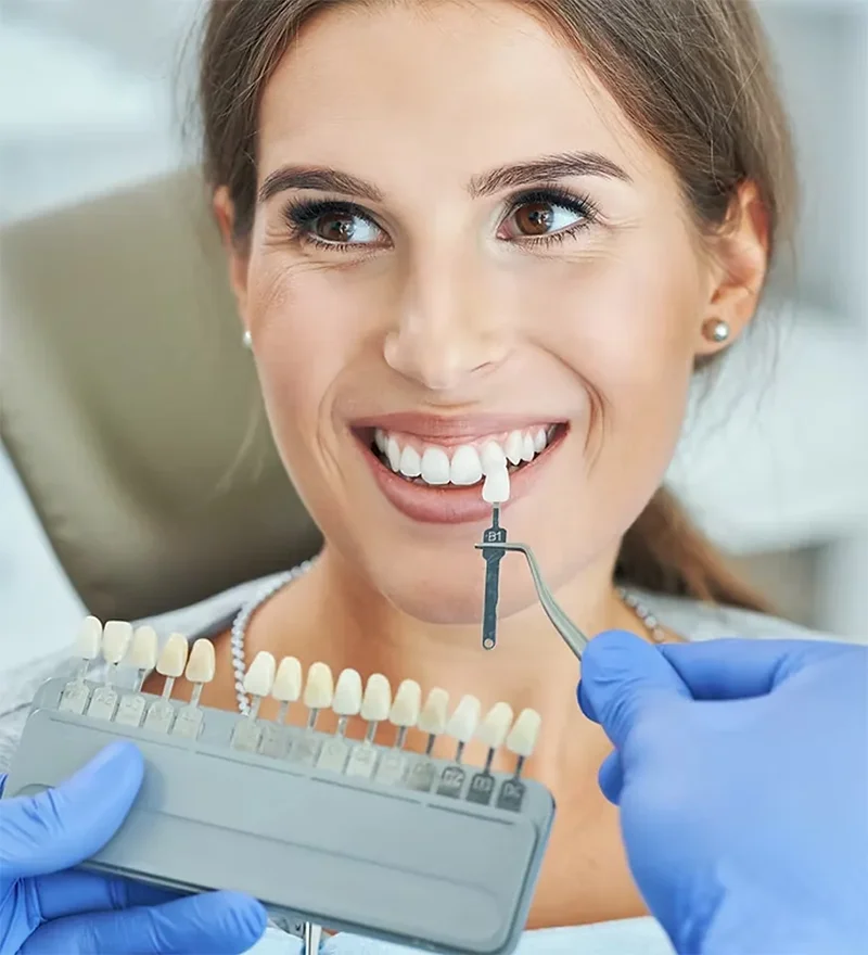 Patient Tooth Color Matching For Porcelain Veneers
