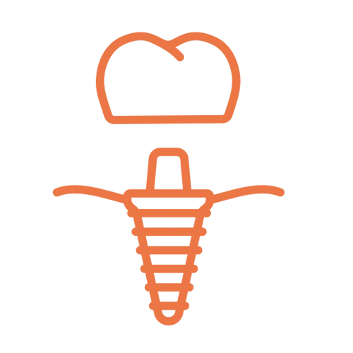 Single Dental Implant Icon