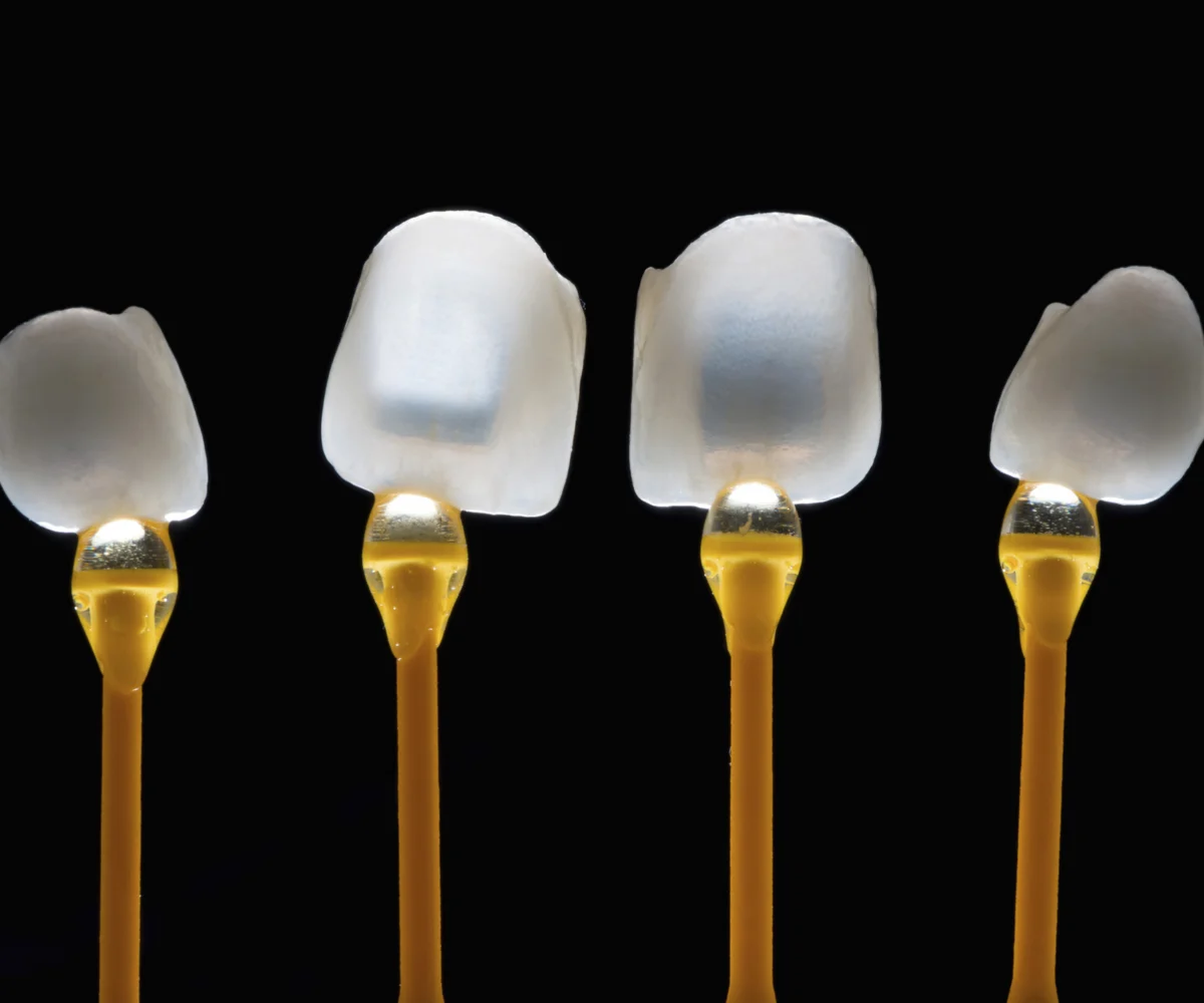 Porcelain Veneers